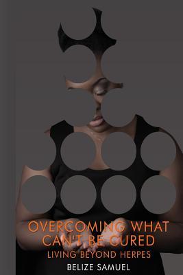 Download Overcoming What Can't be Cured: Living Beyond Herpes - Mrs Belize Samuel | PDF